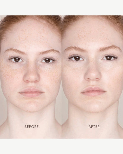 Best Skin Days Treatment Concealer