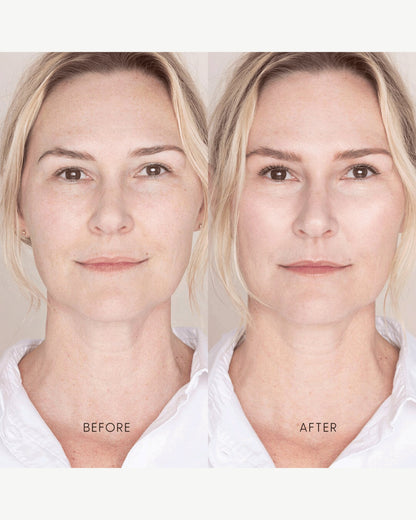 Best Skin Days Treatment Concealer