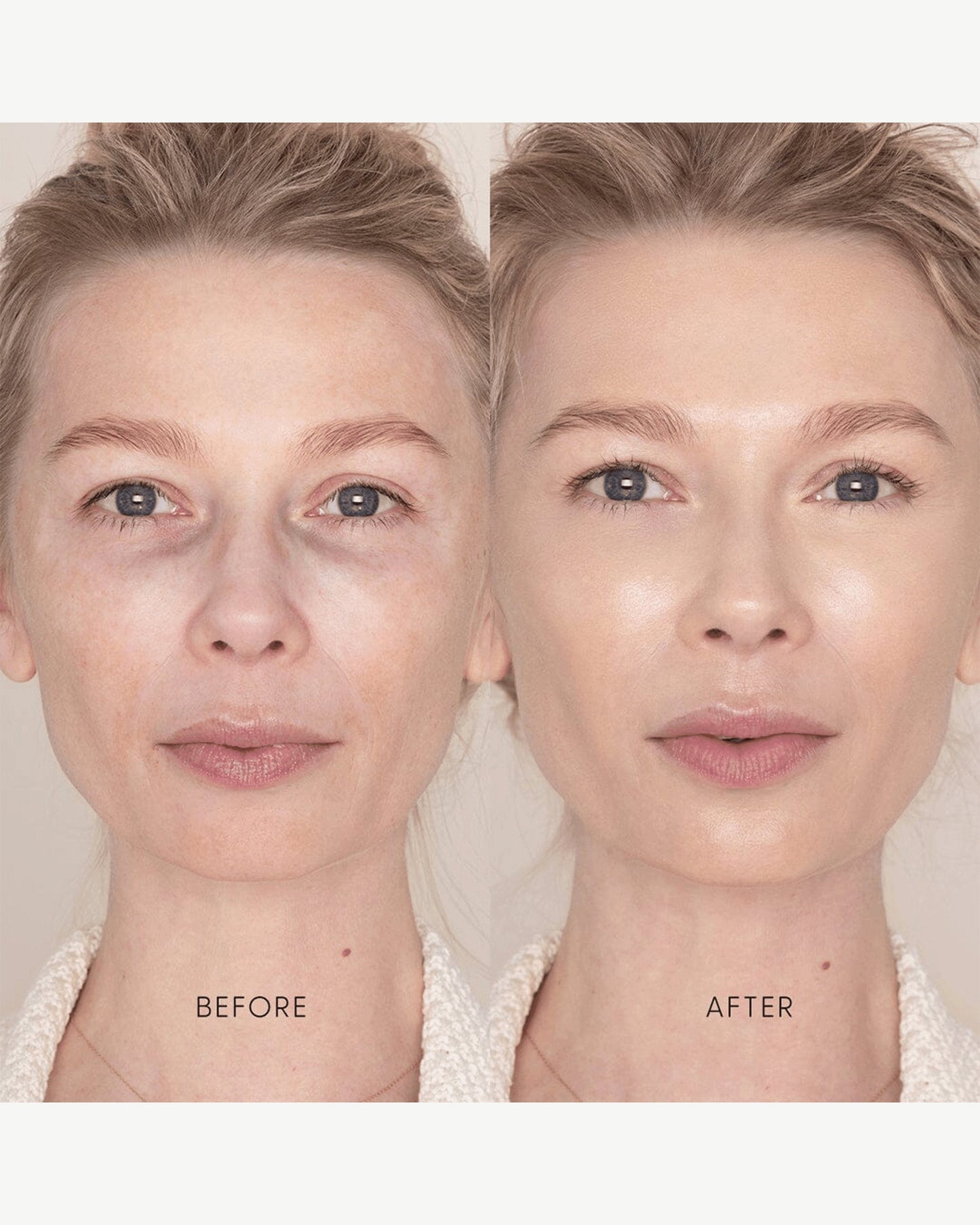 Best Skin Days Treatment Concealer