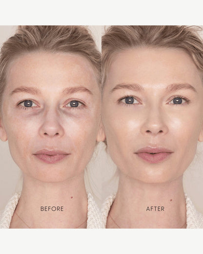 Best Skin Days Treatment Concealer