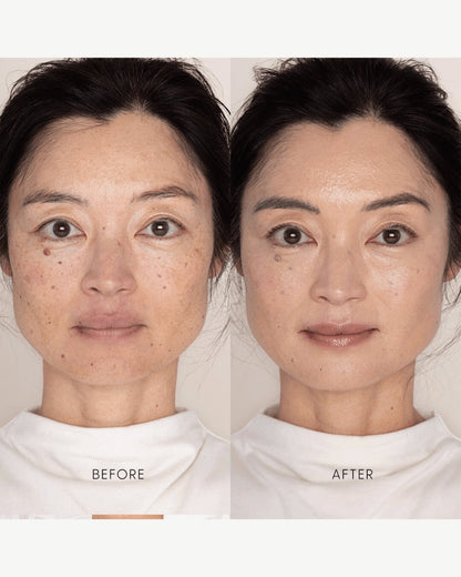 Best Skin Days Treatment Concealer